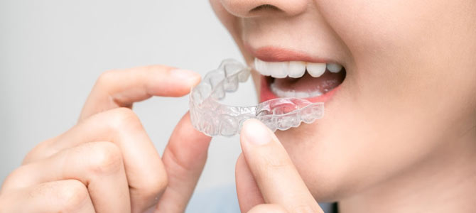 Invisalign Dentist Near Me in Anchorage and Wasilla, AK