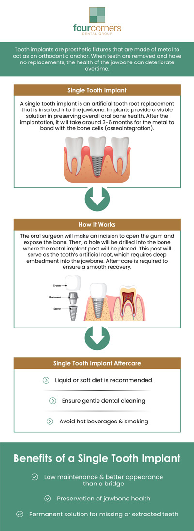 Dr. Pete Higgins, DDS, is a trusted Same Day Tooth Implant Dentist known for delivering efficient, high-quality restorative care. Combining advanced technology with precision dentistry, Dr. Higgins offers same-day dental implant solutions that restore both function and appearance in just one visit. At Same Day Tooth Implant Dentist, he focuses on providing patients with lasting comfort, confidence, and natural-looking results. For more information, contact us today or book an appointment online. We are conveniently located at 3901 Raspberry Rd, Anchorage, AK 99502. Dr. Pete Higgins, DDS, is a trusted Same Day Tooth Implant Dentist known for delivering efficient, high-quality restorative care. Combining advanced technology with precision dentistry, Dr. Higgins offers same-day dental implant solutions that restore both function and appearance in just one visit. At Same Day Tooth Implant Dentist, he focuses on providing patients with lasting comfort, confidence, and natural-looking results. For more information, contact us today or book an appointment online. We are conveniently located at 3901 Raspberry Rd, Anchorage, AK 99502.