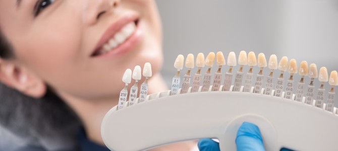 Dental Crowns vs. Veneers: What’s the Difference? | Four Corners Dental Group Near Me in Anchorage, AK