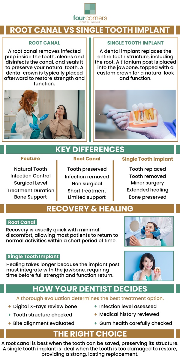 When deciding between a root canal and a single tooth implant, a dentist considers factors such as the extent of tooth damage, the patient's oral health, and long-term prognosis. A root canal is typically prescribed for preserving a natural tooth with manageable damage, while an implant is recommended when the tooth is beyond repair or missing. Meet Dr. Pete Higgings who offers root canal treatment at Four Corners Dental Group. For more information, contact us or book an appointment online. We are conveniently located at 3901 Raspberry Rd, Anchorage, AK 99502.
