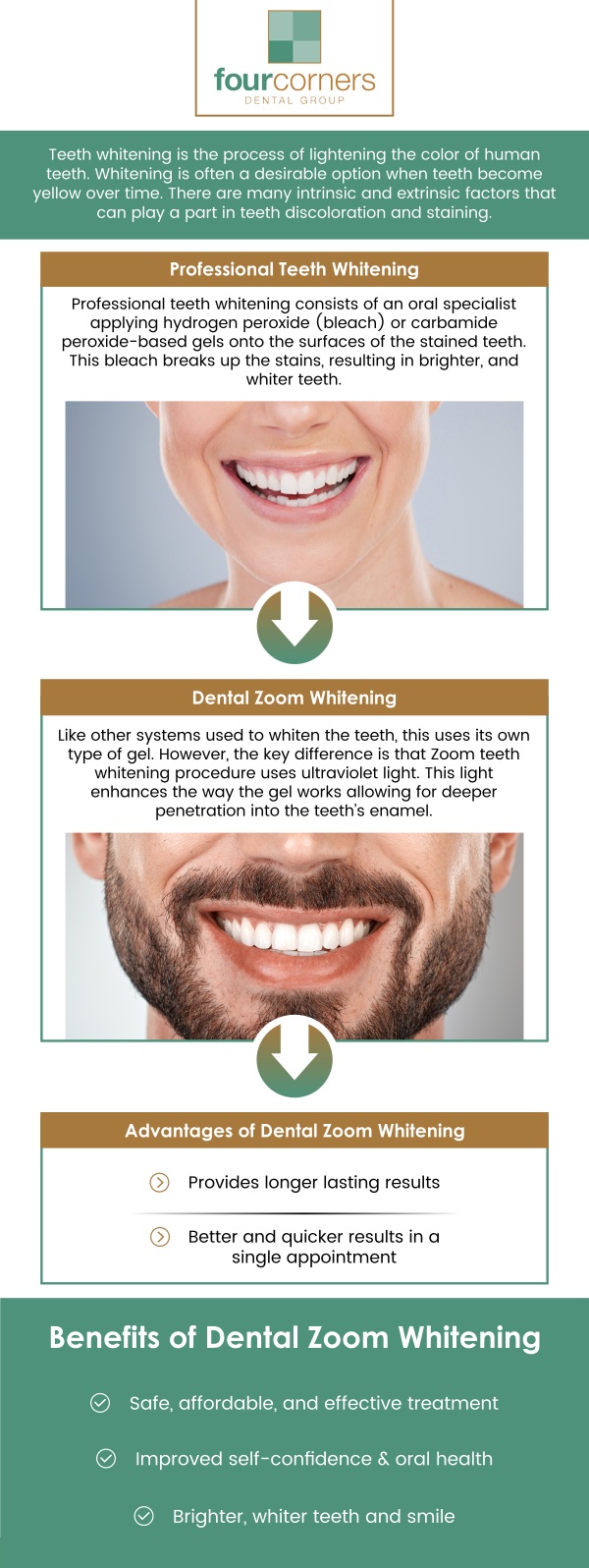 Common questions asked by patients: What is Zoom Teeth Whitening? How long does a Zoom Teeth Whitening session take? How long will the results of Zoom Teeth Whitening last? Can Zoom Teeth Whitening be done if I have sensitive teeth? How Zoom Teeth Whitening Can Enhance Your Smile at Four Corners Dental Group. For more information, contact us or book an appointment online. We are conveniently located at 3901 Raspberry Rd, Anchorage, AK 99502.