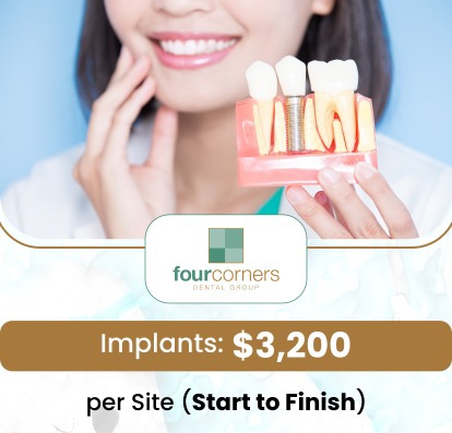 A dental implant procedure typically begins with a comprehensive evaluation, followed by the surgical placement of the implant into the jawbone under local anesthesia. After the implant has integrated with the bone, a custom crown is attached, resulting in a durable and natural-looking tooth replacement. Dr. Pete Higgins offers dental implant procedures at Four Corners Dental Group. For more information, contact us or book an appointment online. We are conveniently located at 3901 Raspberry Rd, Anchorage, AK 99502.