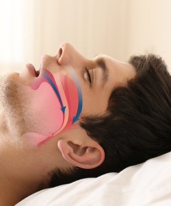 Sleep Apnea Appliances Near Me in Anchorage, AK